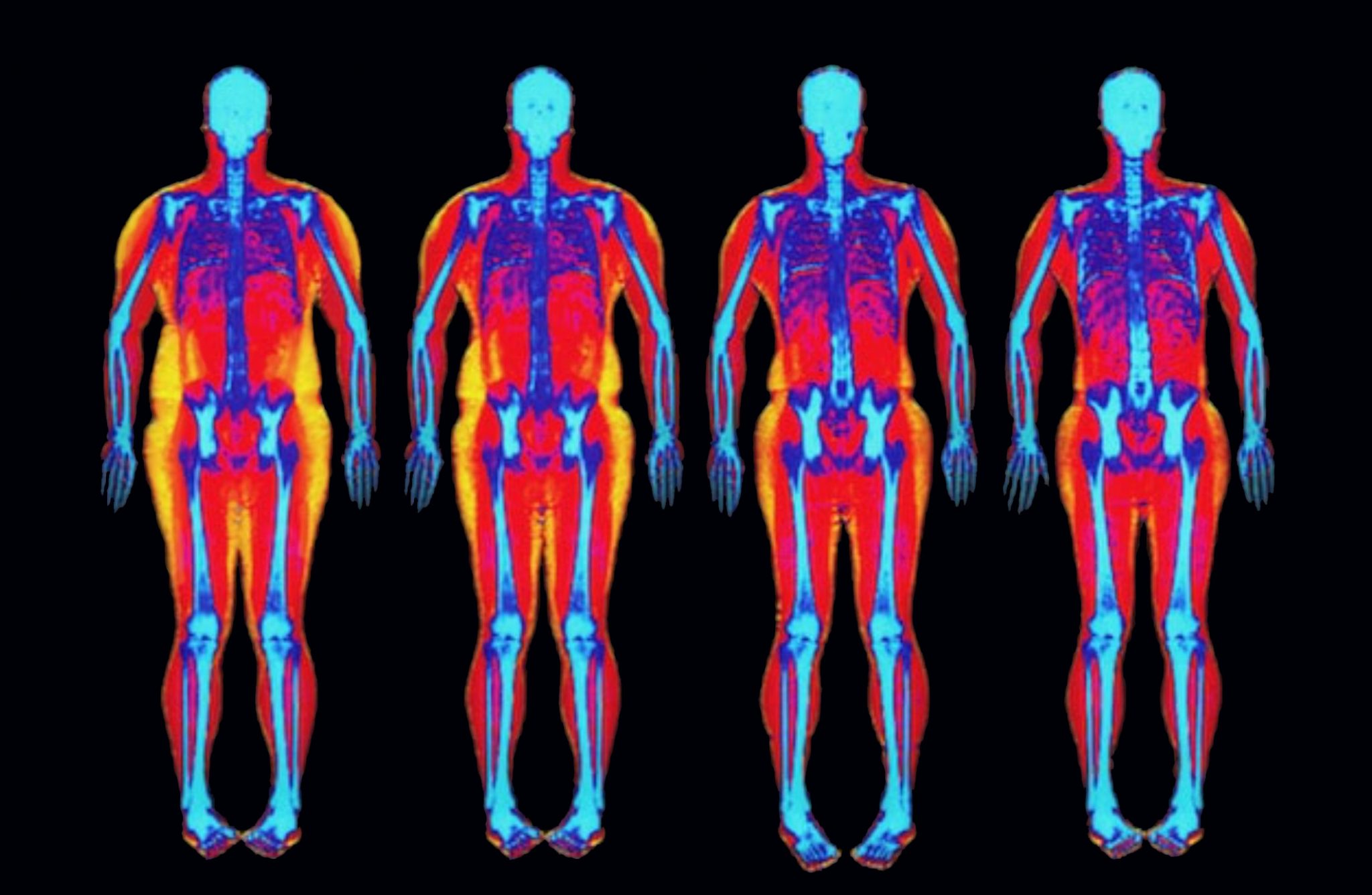 Dexa Progression Male